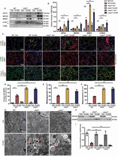 Figure 4. NLRP3 or CASP1 deficiency attenuated mitochondrial injury in the CI-AKI mice through HIF1A and BNIP3-mediated mitophagy. (A and B) Immunoblotting analysis and quantification of HIF1A, BECN1, BNIP3, LC3B-II. (C-F) Representative images and quantification of immunofluorescence double-labeling of LC3B and BNIP3, LC3B and VDAC, VDAC and LAMP1. Scale bar: 20 μm. (G) Representative TEM images of mitochondrial morphology in renal tubular epithelial cells of Ctrl and CI-AKI groups of WT, nlrp3−/−, casp1−/- mice. Mitophagosomes were indicated by arrows. Scale bar: 500 nm. (H and I) Immunoblotting analysis and quantification of EGLN2. Data were presented as mean ± SEM. n = 3–4. *p < 0.05, **p < 0.01, ***p < 0.001