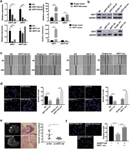 Figure 3. KRT7-AS promoted metastasis of CRC cells by regulating KRT7. (a) RNA level of KRT7-AS and KRT7 was detected by qRT-PCR after knockdown of KRT7-AS (upper left panel) or overexpression of KRT7-AS (upper right panel), respectively, in HCT-116 cells. Expression level of KRT7-AS and KRT7 were detected by qRT-PCR after knockdown of KRT7 (lower left panel) or overexpression of KRT7 (lower right panel), respectively, in HCT-116 cells. (b) KRT7 protein level was detected by Western blot after knockdown or overexpression of KRT7-AS or KRT7. (c, d) HCT-116 cells were transfected with siRNA targeting KRT7-AS (KRT7) or KRT7-AS (KRT7) plasmids. Wound healing assays (c) and transwell assays (d) were performed. For transwell assay, migrated cells were stained with DAPI and images were randomly taken under microscope. Every 6 fields were counted for each sample. (e) HCT-116 cells stably transfected with KRT7-AS shRNA lentivirus were established and injected into nude mice via tail vein. The number of metastatic nodules in each slide was counted after H&E staining. (n = 8 mice per group). GFP signal shows metastatic cells infected by lentivirus in lungs. (f) HCT-116 cells were transfected with shKRT7-AS lentivirus alone or combined with KRT7 overexpression plasmid, and transwell assay was performed. Migrated cells were stained with DAPI and images were randomly taken under microscope. Every 6 fields were counted for each sample. All data are shown as mean ± SD, *p < .05, **p < .01, ***p < .001, ****p < .0001 (unpaired Student’s t test). NC, negative control; Fn, Fusobacterium nucleatum; vec, vector; si, siRNA.