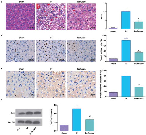 Figure 2. Isoflurane alleviates HIRI in rat liver tissues. (a) Pathological changes in rat liver tissue observed using HE staining (n = 12); (b) apoptosis in rat liver tissue detected by TUNEL staining; (c) Caspase-3 expression in rat liver tissues was assessed by immunohistochemical staining (n = 12); (d) Bax protein expression was detected by Western blot analysis (n = 12); in (a–d), * P < 0.05 vs. the sham group, # P < 0.05 vs. the IR group; the measurement data conforming to the normal distribution were expressed as mean ± standard deviation, one-way ANOVA was used for comparisons among multiple groups, and Tukey’s post hoc test was used for pairwise comparisons after one-way ANOVA