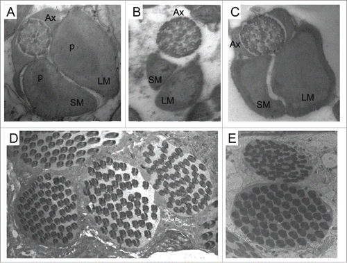 Figure 2. Ultrastructure of transverse sections of the spermatozoal tail of Z. gabonicus (A) showing the paracrystalline material (p) on both mitochondrial derivatives; the axonemes in D. willistoni (B) and Z. davidi (C) have the arrangement of 9 + 9 + 2 microtubules; the cysts containing 64 spermatozoa in Z. camerounensis (D) and Z. tuberculatus (E). Scale: Figures A, B, C: 84000 x; Figures D, E: 10000 x.