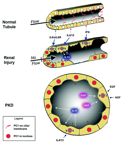 Figure 2. Model on how the cleaved, nuclear PC1 tail can lead to sensitization to STAT-activating growth factors. In normal renal tubule cells, PC1 expression is low and its localization to restricted to primary cilia and cell junctions (red). Renal injury leads to increased PC1 expression, cleavage of its cytoplasmic tail that then traffics to the nuclei (red) where it can co-activate STAT transcription factors. Depending on the growth factor/cytokine environment, different STATs will be activated. In injured tubules, this will lead to amplified STAT activity whereas intact tubules should be relatively insensitive (due to lack of nuclear PC1 tail). Different cytokines will lead to different responses. For example, IL13 secretion by M2 macrophages would cause STAT6 activation in tubule cells which may activate tissue regeneration. In contrast, interferon secretion by M1 macrophages may trigger cell death by activation of STAT1 in damaged tubule cells. In PKD, overexpression of (mutated) PC1 may lead to constitutively high levels of the nuclear PC1 tail which will hyper-sensitize tubule cells to cytokine signaling leading to inappropriate responses. Because factors secreted into cyst lumens cannot escape, positive feedback loops establish themselves which lead to persistent activation of STAT6 and STAT3.