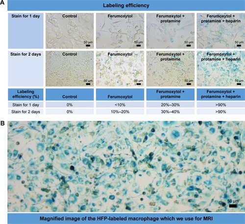 Figure 2 (A) Labeling efficiency of different labeling methods. The labeling efficiency of ferumoxytol only (,20%) or combining ferumoxytol and protamine (,40%) was relatively poor, while self-assembling nanocomplexes formed by combining ferumoxytol, heparin, and protamine could achieve a high labeling efficiency (.90%). (B) Magnified image of HPF-labeled macrophage stain used for MRI. Magnification 5×20.Abbreviations: HPF, heparin, protamine, and ferumoxytol; MRI, magnetic resonance imaging.