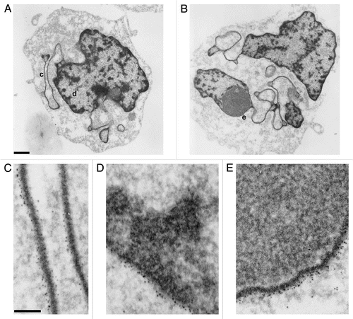 Figure 7 Immunoelectron microscopic labeling of the epichromatin epitope at the NE periphery and within ELCS of RA treated HL-60/S4 cells. (A and B) display two different cells which exhibit nuclear lobulation and extensive formation of ELCS. Enlarged regions taken from (A and B) are as follows: (C) taken from (A) (region “c”), presents two parallel ELCS; (D) taken from (A) (region “d”), displays a segment of the nuclear surface; (E) taken from (B) (region “e”), shows a single peripheral heterochromatin layer adjacent to a nucleolus. The NE and ELCS membranes can not be visualized because of the post-fixation detergent extraction and because the samples were not fixed with OsO4. Magnification bar values: (A and B) 1 µm; (C–E) 100 nm.
