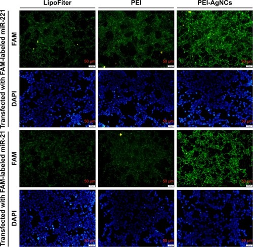 Figure 6 The inverted fluorescence microscopy images of 293A cells after exposure to different polyplexes for 12 hours. 293A cells were treated with LipoFiter/F-miR-21/221m, PEI/F-miR-21/221m, and PEI-AgNCs/F-miR-21/221m. The green fluorescence denotes the F-miRm and the blue fluorescence denotes the DAPI-stained cell nucleus. Scale bar, 50 µm.Abbreviations: PEI-AgNCs, polyethyleneimine-capped silver nanoclusters; F-miR-21/221m, FAM-labeled miR-21 or 221 mimics; F-miRm, FAM-labeled miRNA mimics; FAM, fluorescein amidite.