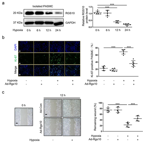 Figure 1. RGS10 suppresses hypoxia-induced proliferation and migration of PASMC. (a) the relative expression of RGS10 was analyzed by immunoblotting in PASMC after 0, 6, 12 or 24 h of hypoxia stimulus (post hoc for LSD test; n = 6 samples per group). PASMC was transfected with Ad-Con or Ad-Rgs10 and then received normoxia or hypoxia stimulus. (b) PASMC as above treated was stained with Ki-67 (green) and DAPI (blue). Representative images (left) and corresponding quantification of Ki-67-positive PASMC (right) were shown (post hoc for LSD test; n = 6 samples per group). Bar = 50 μm. (c) migration of PASMC as above treated was analyzed by wound healing assay. (post hoc for LSD test; n = 6 samples per group). Bar = 200 μm. Data are shown as mean ± S.D. ***P < .001 denotes statistical comparison between the two marked groups, respectively.