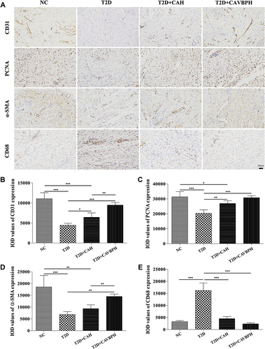 Figure 6 IHC staining of CD31, PCNA, α-SMA, and CD68 proteins. (A) Representative images for CD31, PCNA, α-SMA, and CD68 (scale bar = 200 μm). (B–E) Quantification analysis of CD31, PCNA, α-SMA, and CD68 proteins expression in wound tissues, respectively. *p < 0.05, **p < 0.01, and ***p < 0.001.