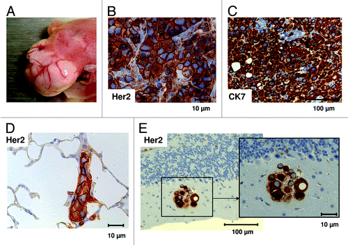 Figure 1. Tumor development and metastases in HTM. (A) Tumor growth and vascularization in the liver of BT474 transplanted HTM three months post transplantation. Human breast cancer origin was proven by immunohistochemical staining for HER2 (B) and Cytokeratin-7 (C) in tumors of HTM. SK-BR-3 transplanted HTM showed tumor cell dissemination in lung (D) and brain (E) stained with anti-HER2 antibody. Bars indicating the corresponding size (10, 100 µm) are shown for each specimen.