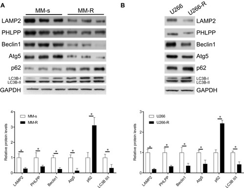 Figure 1 The expression of PHLPP in bortezomib-resistant MM cells. (A) Western blot analyses of the expression of PHLPP, LAMP2, and key autophagy signaling molecules in bone marrow samples from patients with MM (upper), and quantification of the bands (lower). (B) Western blot analyses of the expression of PHLPP, LAMP2, and key autophagy signaling molecules in U266 cells and bortezomib-resistant U266 cells (upper), and quantification of the bands (lower). MM-S, BTZ-sensitive MM; MM-R, BTZ-resistant MM; U266-R, BTZ-resistant U266 cells. *P < 0.05.
