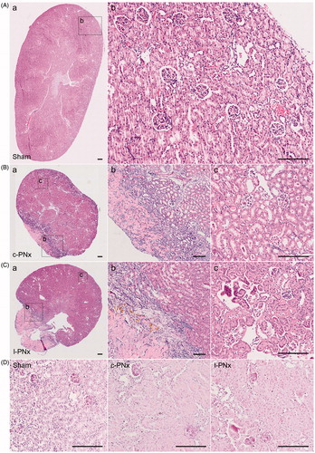 Figure 4. No pathological difference between c-PNx and l-PNx model kidney at 4 weeks post-operation. (A) H&E staining of kidney in sham group after surgery 4 weeks ((Aa) is a × 40 image, (Ab) is a magnified image from (Aa) with ×200 magnification). (B) H&E staining of kidney in c-PNx group after surgery 4 weeks ((Ba) is a × 40 image, (Bb) is a magnified image of junction portion of necrosis and normal from (Ba) with ×100 magnification, and (Bc) is a magnified image of normal portion from (Ba) with ×200 magnification). (C) H&E staining of kidney in l-PNx group after surgery 4 weeks ((Ca) is a × 40 image, (Cb) is a magnified image of junction portion of necrosis and normal from (Ca) with ×100 magnification, and (Cc) is a magnified image of normal portion from (Ca) with ×200 magnification). (D) PAS staining of kidney in each group (×200 magnification).
