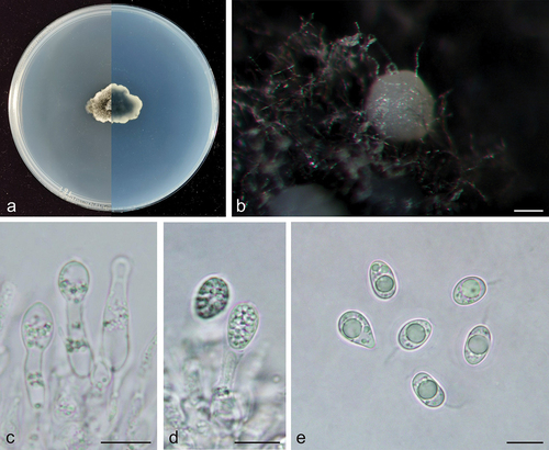 Figure 4. Phyllosticta machili (holotype, CAF 8000203). a: Colonies (left-above, right-reverse) after 7 days on PDA; b: Conidiomata; c, d: Conidiogenous cells with conidia; e: Conidia. Scale bars: 200 μm (b); 10 μm (c–e).