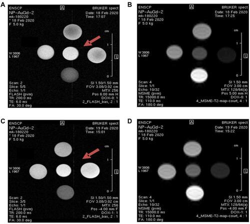 Figure 4 Examples of T1 and T2 weighted MR images of Gd-AuNRs: alone (A and B), respectively, DOX IN-Gd-AuNRs (C and D).