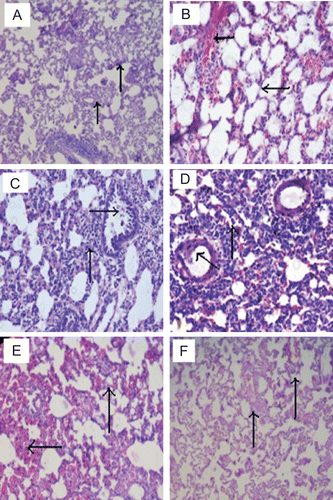 Figure 1.  Effects of chrysin on pulmonary morphological changes. The lung sections from (A) NS, non-sensitized = OVA-challenged, treated with vehicle, (B) S, sensitized = OVA-sensitized and challenged, treated with vehicle), (C) Dexa, OVA-sensitized and challenged, treated with dexamethasone 1 mg/kg, (D) CHR3, (E) CHR10 and (F) CHR30 = OVA-sensitized and challenged, treated with chrysin 3, 10, and 30 mg/kg, p.o., respectively. Arrows showing hemorrhage, hyperplasia of epithelial cells.