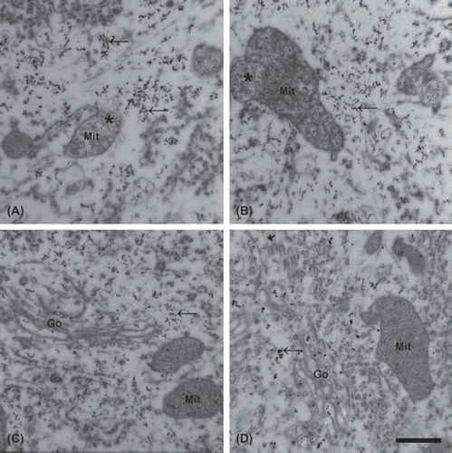 Figure 1. Increased calcium level in the lumbar motor neurons of mutant SOD1 Tg mice. An increased number of electron-dense deposits (EDDs; arrows) is noted, reflecting the distribution of calcium in the motor neurons in the talampanel-treated (A) and the vehicle-treated (B) mutant SOD1 Tg mice at the age of 19 weeks. Motor neurons from the wild-type mice at the same age contain fewer deposits, regardless of whether they were treated with talampanel (C) or with vehicle only (D). Besides the increased number of EDDs in the mutant SOD1 Tg animals, mitochondrial degeneration with clusters of EDDs (asterisk) was frequently seen. In the wild-type animals, regardless of the treatment, no structural alterations were present. Mit: mitochondrion, Go: Golgi complex. Bar: 500 nm.