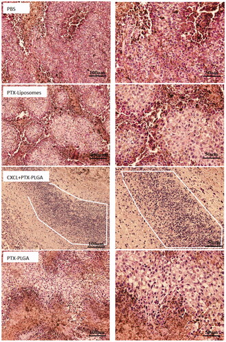 Figure 8. Histopathologic examination of tumor tissues after treatment with H&E staining. (left, 20×; right, 40×. The white line enclosed circle represents accumulation of neutrophils).