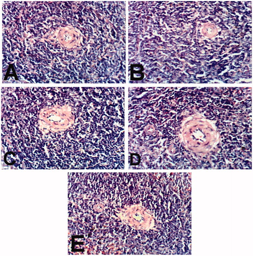 Figure 5. Spleen of rats treated with indomethacin (A), BCO (B), COO (C), CLO (D), and control (E) showing no histopathological changes (H & E x 400).