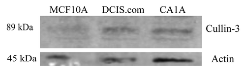 Figure 1. The expression of Cullin-3 protein in breast cell lines. Whole cell lysates of MCF10A, MCF10DCIS.com (DCIS.com) and MCF10CA1A (CA1A) cells were analyzed by western blot. Membrane was probed with anti-Cullin-3 antibody. Actin was used as a loading control.