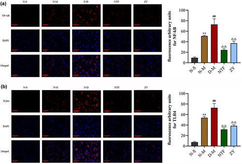 Figure 7 Effects of Naotaifang III on TLR4 and NF-κB expression in brain cortex (immunofluorescence staining, 400×).