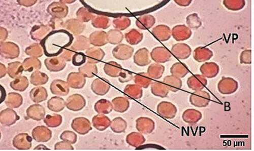 Figure 2. Viable (VP) and non-viable (NVP) pollen grains of Polylepis incarum stained with tetrazolium, and the presence of bubbles (B)