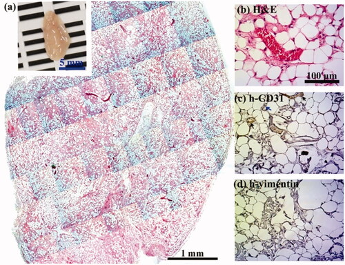 Figure 10. Crosslinking modulation of vascularized adipose tissue graft in collagen-Ph hydrogels. 0.6% Collagen-Ph pre-polymer solutions with ECFCs and MSCs in the absence of any exogenous cytokines were subcutaneously injected into nude mice and formed cell-laden collagen-Ph hydrogels under suitable concentrations of HRP and H2O2. Constructs were evaluated after 1 month in vivo. (a) The macroscopic view (inset, scale bar 5 mm) and representative H&E-stained section of entire cell-laden collagen-Ph constructs are shown (scale bar 1 mm). Adipose tissue covers entire construct. (b–d) High magnification of selected regions shows some murine adipocytes (human vimentin-negative) with some human vessels (human CD31-positive, black arrows)/murine vessels (human CD31-negative, blue arrows) carrying erythrocytes.