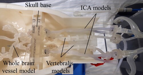 Figure 12. Whole-brain vessel model in HANNES for the final test series. For this purpose, another ICA model was connected as well as the posterior cervical arteries, the vertebral models.