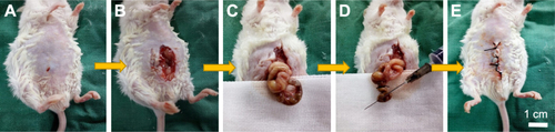 Figure S3 Critical steps in the CLP procedure in mice (A–E).Abbreviation: CLP, cecal ligation and puncture.