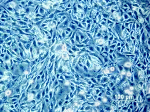 Figure 1. CHO K1 (Chinese hamster ovary) cells at 17 h post plating (image is from the Health Protection Agency Culture Collections website: www.hpacultures.org.uk/products/celllines/generalcell/detail.jsp?refId = 85051005&collection = ecacc_gc