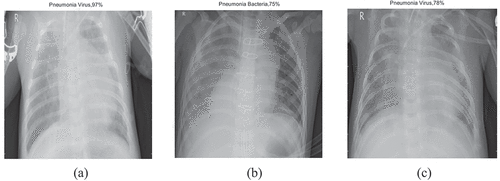 Figure 14. Chest-X ray classification- 2nd stage results using (a) ResNet-50, (b) SqueezeNet, (c) EfficientNet-b0.