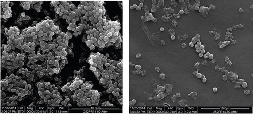 Fig. 2.  Scanning electron microscopy images of untreated and treated biofilms with the phage EFDG1. The image on the left shows a well-developed biofilm, while the right image is one with EFDG1 phage treatment. Both the biofilms are 2 weeks old.