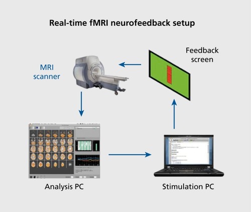 Figure 1. Basic diagram of a real-time functional magnetic resonance imaging brain-computer interface for neurofeedback. Figure courtesy of Isabelle Habes
