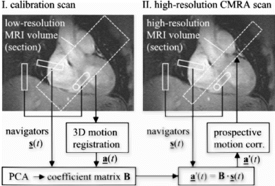 Figure 1. Patient-specific motion model calibration and its subsequent application for prospective motion correction.