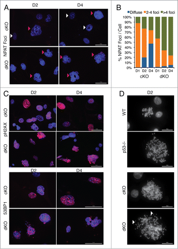 Figure 4. Removal of p53 in Hinfp null cells alters histone locus body (HLB) patterns and induces genomic instability. (A) IF microscopy shows the distribution of HLB by staining for the marker protein NPAT (red), an integral component of HLBs. cKO MEFs show an increase in the fraction of cells with multiple NPAT foci (red arrowheads) or diffused NPAT staining (white arrowheads) after Hinfp depletion. dKO MEFs show a further increase in cells with multiple NPAT foci. Nuclei were co-stained with DAPI (blue). Scale Bar 50 µm. (B) Quantitation of NPAT staining patterns in cKO and dKO MEFs at d1, d2 and d4 after removal of Hinfp. Nuclei were counted from 2 biological replicates (200 each) per sample for each time point. (C) cKO and dKO MEFs were analyzed for factors associated with double-strand DNA damage using immunofluorescence microscopy. (Upper panels) γ-H2Ax S-139 (red) and Scale Bar 50 µm. (Lower panels) 53BP1 (red) Scale Bar 50 µm. Nuclei were co-stained with DAPI (blue). Both cKO and dKO MEFs show cells with focal staining for both γ-H2Ax and 53BP1 that is even higher in dKO cells. (D) WT, p53−/−, cKO and dKO MEFs were mitotically arrested at D2 using Colcemid (100 ng/ml). The mitoses were analyzed by fluorescence microscopy. The DNA was stained with DAPI. cKO cells have an increased chromosome complement compared to WT, and there is increased appearance of chromosomal fragility (white arrowheads) in cells lacking both p53 and Hinfp. Scale Bar 20 µm.