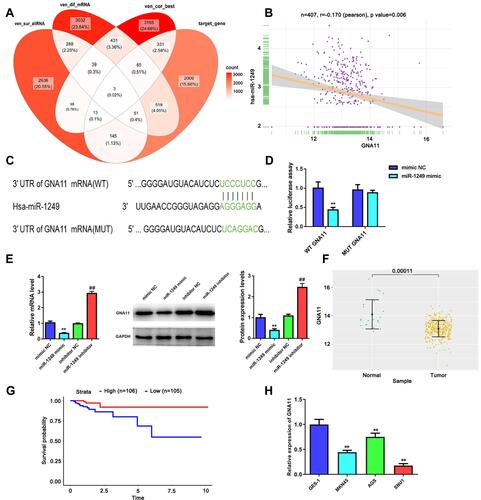 Figure 3 GNA11 is negatively modulated by miR-1249 and is lowly expressed in gastric cancer tissues and cell lines. (A) There were three common genes were gained from the intersection of veen diagram. (B) In gastric cancer samples, GNA11 expression was negatively related to miR-1249 expression, which was analyzed by Pearson correlation coefficient. (C) The 3ʹUTR of GNA11 containing the wide type (WT) or mutant type (MUT) binding sites between GNA11 and miR-1249. (D) The relative luciferase activity of GNA11-WT was decreased in miR-1249 mimic group compared to mimic NC group. **p < 0.01 vs mimic NC group. (E) The mRNA and protein levels of GNA11 in miR-1249-overexpressing or miR-1249-depletion in gastric cancer cells. **p < 0.01 vs mimic NC group. ##p < 0.01 vs inhibitor NC group. (F) GNA11 was lowly expressed in gastric cancer tissues relative to normal samples. (G) Kaplan–Meier analyzed the association of high and low GNA11 expression with the overall survival in gastric cancer patients. (H) GNA11 was down-regulated in all gastric cancer cell lines (AGS, MGC-803 and SNU1) relative to that in normal cell line GES-1. **p<0.01 vs GES-1 group.