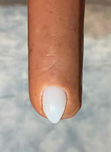 Figure 2. Finished toenail model created using a sausage and an artificial nail