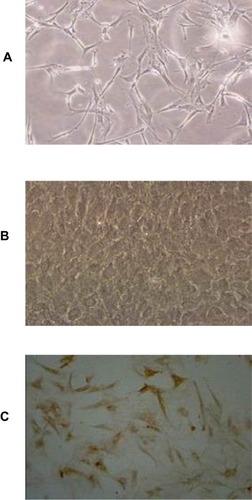 Figure 1 Morphology of primary BMEC. (A) Representative image of 1-day primary cultured BMEC under light microscope (×100), (B) Representative image of 10–13d primary cultured BMEC under light microscope (×100), (C) Immunohistochemistry staining for vascular endothelial cell marker factor VIII under light microscope (×100).