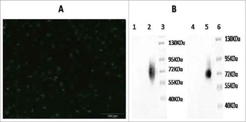 Figure 2. Delection of the fusion gene GM-CSF and LMP2A expression in recombinant adenovirus. A. The 293 cells transfected by recombinant adenovirus vectors (200 ×,56 h). B. Western blotting analysis of expressed (Lane 1 = western blotting with GM-CSF of Adenovirus 5 control; lane 2 = western blotting with GM-CSF of vAd-GC2A; lane 3 = Protein Markers; lane 4 = western blotting with LMP2A of Adenovirus 5 control; lane 5 = western blotting with LMP2A of vAd-GC2A; lane 6 = protein markers).