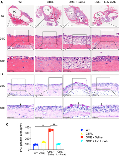 Figure 4 IL-17 mAb ameliorated OME in rats. (A) The severity of the middle ear injury was evaluated by HE staining at 1×, 30×, and 60× magnification (TC, tympanic cavity). (B) Representative photos are the PAS-stained middle ear sections in different groups. The goblet cells (arrows) and the secretion of mucin was evaluated by PAS staining at 30× and 60× magnification. The positivity of PAS staining was purple-red. The statistical analysis of all data from three rats is presented (C). **P < 0.01, ##P < 0.01. Data are representative of three independent experiments.