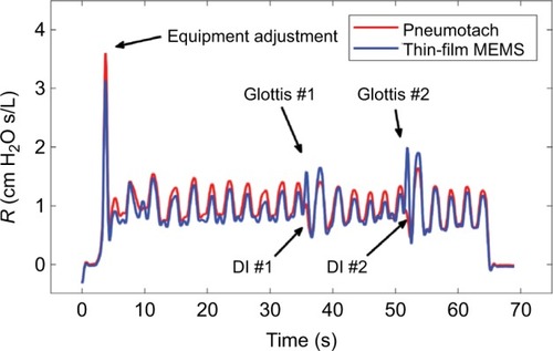 Figure 5 Comparison of the airway resistance (R) during Trial 3 for the pneumotach and thin-film sensor connected in series.