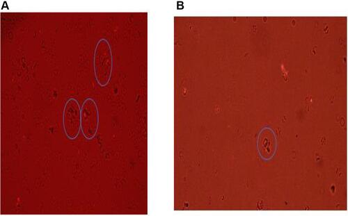 Figure 3 Micrograph showing parasite isolate rosettes from (A) blood group A type rosette and (B) blood group O type. (A) Large rosettes seen in blood group type B (B) Small rosettes seen in blood group type O.