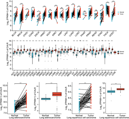 Figure 1. (a). The expression of CALR in pan-cancer and corresponding normal tissues derived from TCGA database. (b) The expression of CALR in pan-cancer and corresponding normal tissues derived from TCGA database in addition to normal lung tissues derived from GETx database. (c). The expression of CALR in TCGA-LUAD database and matched normal tissues. (d). The expression of CLAR in TCGA LUAD tissues compared to that of TCGA and GETx normal lung tissues. (e). The expression of CALR in TCGA-LUSC database and matched normal tissues. (f). The expression of CLAR in TCGA LUSC tissues compared to that of TCGA and GETx normal lung tissues.