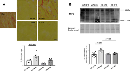 Figure 8 (A) Representative images of Picrosirius staining for quantification of heart fibrosis in wild-type mice treated with normal (WT-NFD) or high (WT-HFD) fat diet, or P2X7 purinergic receptor (P2X7R) receptor knockout mice treated with normal (KO-NFD) or high fat diet (KO-HFD). A positive control (db/db mice treated with HFD, CTL+) is also shown. Magnification: x40. Scale bar: 20μm. A staining quantification in the four groups of animals is shown. The threshold analysis was performed as described in Materials and Methods section. (B) Representative Western blot of TGFβ heart protein expression in wild-type mice treated with normal (WT-NFD) or high (WT-HFD) fat diet, or P2X7R knockout mice treated with normal (KO-NFD) or high fat diet (KO-HFD). Results are expressed as arbitrary units (A.U.). Arrows indicate different TGFβ isoforms. Data are presented as mean±SE for at least six animals in each group. Two-way ANOVA with genotype and diet as sources of variation, followed by Tukey’s post-hoc test, was used for multiple comparisons. Statistical significance was set at p < 0.05. ● WT-NFD, ■ WT-HFD, ▲ KO-NFD, ◆ KO-HFD.