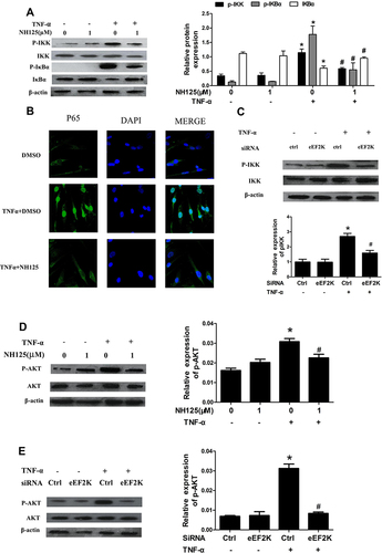 Figure 4 eEF2K inhibition suppressed TNF-α-induced NF-κB and AKT activation of RA FLSs. RA FLSs were pre-treated with DMSO or NH125 (1.0μM) for 24 h or transfected with eEF2K-siRNA or control si-RNA (si-C). Then cells were stimulated with TNF-α (10 ng/mL) for 15 min. (A) Effect of NH125 on IKK and IκBα phosphorylation was measured by Western blot. (B) Representative laser confocal microscopy images showed effects of NH125 on TNF-α-induced translocalization of p65 (p65 stained with green, nuclei stained with blue). (C) eEF2K knockdown on TNF-α-induced IKK phosphorylation. (D and E) Effects of NH125 or eEF2K-siRNA on the expression of AKT and p-AKT were measured by Western blot. Data were representative as means ± SD. *P < 0.05 vs DMSO control or si-C, #P < 0.05 vs treatment with TNF-α alone.