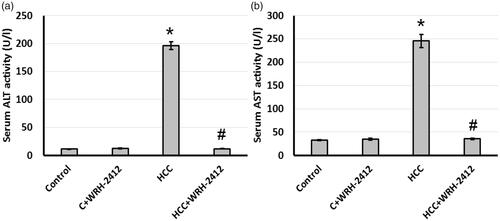 Figure 3. Effect of WRH-2412 on serum liver markers levels in HCC rats. (a) ALT (b) AST levels. Values are expressed as the mean ± SEM, *p < 0.05 vs. control; #p < 0.05 vs. HCC group; ALT: alanine aminotransferase; AST: aspartate aminotransferase; HCC: hepatocellular carcinoma; C: control.