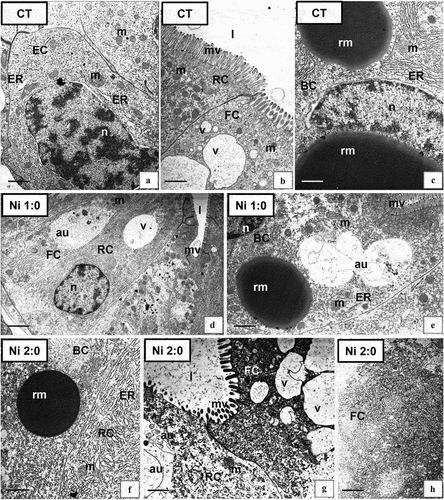 Figure 4. Ultrastructure of the hepatopancreas of N. davidi in experimental groups: CT (a–c), Ni 1:0 (d,e), Ni 2:0 (f–h). TEM. EC - embryonic cell, FC - F-cell, RC - R- cell, BC - B-cell, n - nucleus, ER - cisterns of endoplasmic reticulum, mv - microvilli, l – midgut lumen, m - mitochondria, rm - reserve material, au - autophagosome, v – vacuole. Scale bar: (a) 1 μm, (b) 1 μm, (c) 0.86 μm, (d) 2.4 μm, (e) 1.4 μm, (f) 1 μm, (g) 0.8 μm, (h) 0.8 μm.