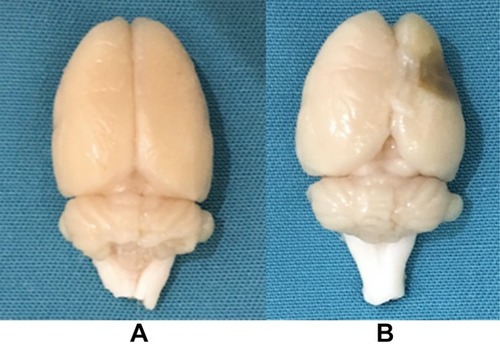 Figure 2 (A) The brain tissue of the control group; (B) The brain tissue of the post-stroke depression group.