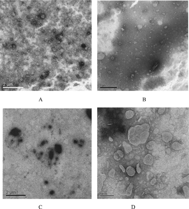 FIG. 1 Transmission electron microscopy of cationic liposomes and their oligonucleotides complexes. (A) Cationic liposomes without modification (CL); (B) SG/PEG-DSPE-modified liposomes (SG/PEG-CL); (C) complexes of nonmodified cationic liposomes with ODN (CL-ODN complexes); (D) complexes of SG- and PEG-DSPE-modified catiomic liposomes with ODN (SG/PEG-CL-ODN complexes).