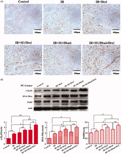 Figure 7. NP H1/Dbait/Dtxl increased the expression levels of DNA damage response effectors in vivo. (A) Effect of H1/Dbait/Dtxl on γ-H2AX expression in PC-3 tumours detected by immunohistochemistry. (B) Effect of H1/Dbait/Dtxl on γ-H2AX, DNA-PKcs and PARP expression in PC-3 tumours detected by Western blot, the band intensity were quantified after normalised to actin, respectively. *p < .05, **p < .01, n = 3.