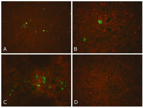 Figure 3. A–D: Dutch C. burnetii strains on the Buffalo Green Monkey (BGM) cell culture system. Results of the immunofluorescence staining of a BGM cell culture using a C. burnetii specific monoclonal antibody (MAB313-oregon green, Squarix). The presence of C. burnetii is indicated by the green dots. The nuclei of the BGM cells are stained brownish with propidium iodide (Roest et al. Citation2010). A: The first Dutch C. burnetii strain isolated from the placenta of a goat (strain X09003262-001, 100× magnification). B: close-up of Figure 3(A) (400× magnification). C: C. burnetii strain isolated from the placenta of a sheep (400× magnification). D: non-infected BGM cells (negative control) (400× magnification).