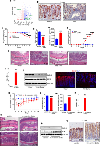 Figure 1. Robust decrease in CLDN3 expression characterize IBD patients and mice subjected to colitis.
