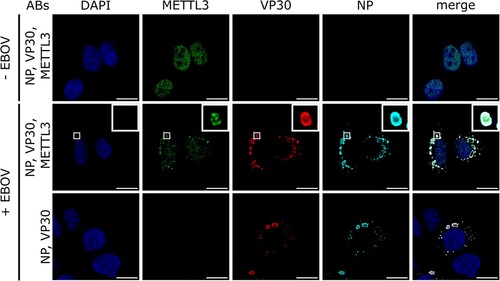 Figure 2. METTL3 localizes to EBOV inclusion bodies. Huh7 cells were infected with rgEBOV-NP-flagHA (MOI = 10) or remained uninfected. At 24 hpi, cells were fixed, permeabilized and stained for METTL3 and EBOV VP30 using protein-specific antibodies and for EBOV NP using an anti-HA antibody. Scale bars indicate 20 µm and insets show magnifications of indicated areas. Representative results from two independent experiments are shown.