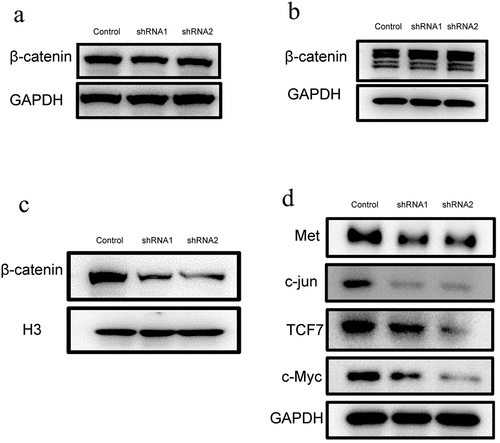 Figure 5. Down-regulation of Kindlin-2 expression inhibits β-catenin nuclear transport. a: β-catenin protein expression in endothelial cells (including cytoplasm and nucleus) was detected by Western blots in the control group, kindlin-2 shRNA1 group and kindlin-2 shRNA2 group. b: The expression of β-catenin protein in the cytoplasm was detected by Western blots in the control group, kindlin-2 shRNA1 group and kindlin-2 shRNA2 group. c: The protein expression of β-catenin in the nucleus was detected by Western blots in the control group, kindlin-2 shRNA1 group and kindlin-2 shRNA2 group. d: The protein expression levels of Met, c-Jun, TCF7 and c-Myc in the control group, Kindlin-2 shRNA1 group and Kindlin-2 shRNA2 group were detected by Western blots